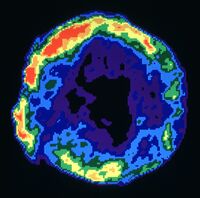 Tycho&#039;s Supernova Remnant (3c10)