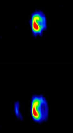RS Ophiuchi Expansion