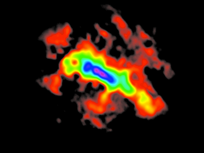 Starburst and Outflow